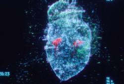 Computer generated image of a heart