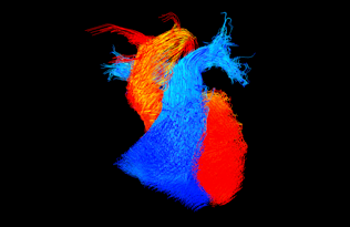 an image of a heart