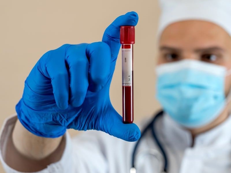 Doctor looks at tube containing a blood test sample